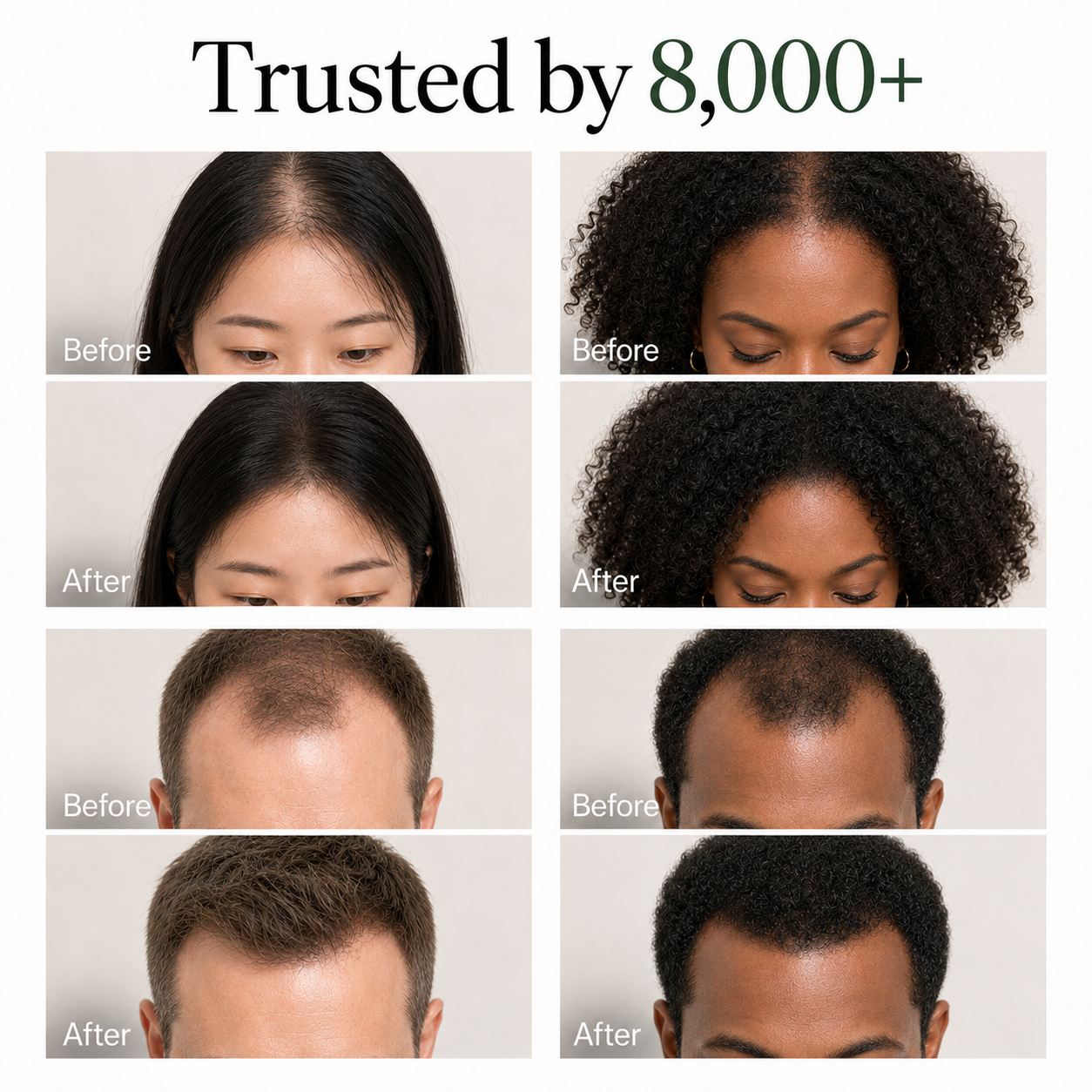 Korean Scalp Growth Bar